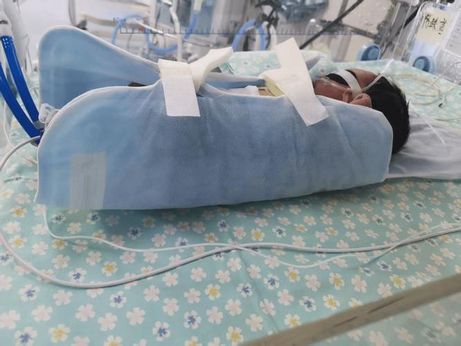 锦医一院专业亚低温治疗设备助力保护hie新生儿脑功能